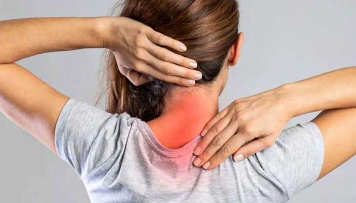 © SBCO/Divulgação Câncer de cabeça e pescoço é o terceiro mais comum no Brasil